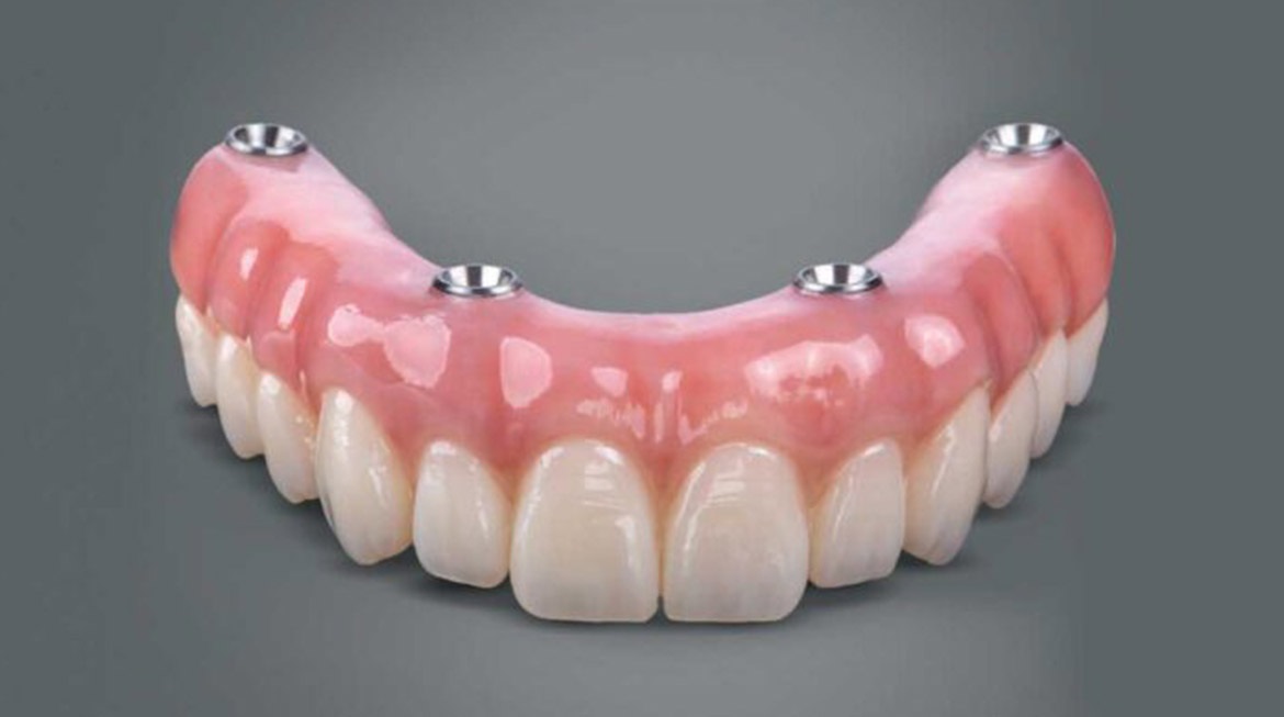 Dentist Supports
